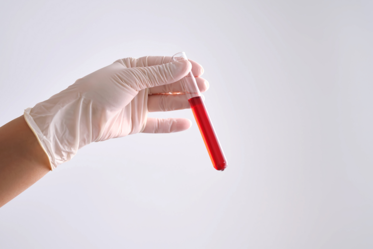 A gloved hand holding a test tube with red liquid, symbolizing the GRAIL Galleri test.